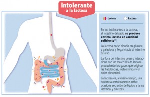 intolerante a la lactosa